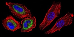 CNG1 Antibody (CNC 9C1), Novus Biologicals 0.1mL; Unlabeled:Antibodies,