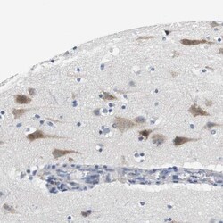CNGA2 Antibody, Novus Biologicals 25 &mu;L; Unlabeled:Antibodies, Polyclonal