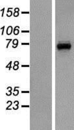 Novus Biologicals&trade;&nbsp;CNGA3 Overexpression Lysate