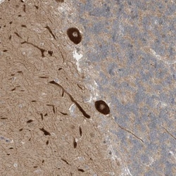 CNKSR1 Antibody, Novus Biologicals 25 &mu;L; Unlabeled:Antibodies, Polyclonal