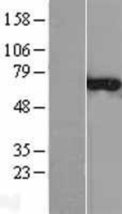 Novus Biologicals&trade;&nbsp;CNKSR3 Overexpression Lysate