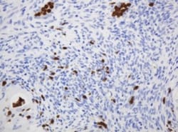 CNKSR3 Antibody (OTI1D7), Novus Biologicals 0.1mL; Unlabeled:Antibodies,