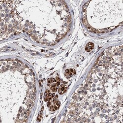 CNNM1 Antibody, Novus Biologicals 0.1mL; Unlabeled:Antibodies, Polyclonal