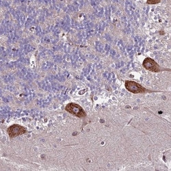 CNO Antibody, Novus Biologicals 0.1mL; Unlabeled:Antibodies, Polyclonal