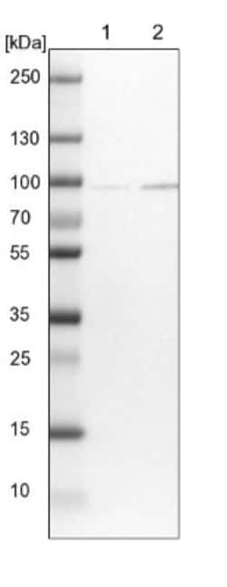 CNOT10 Antibody, Novus Biologicals 0.1mL; Unlabeled:Antibodies, Polyclonal