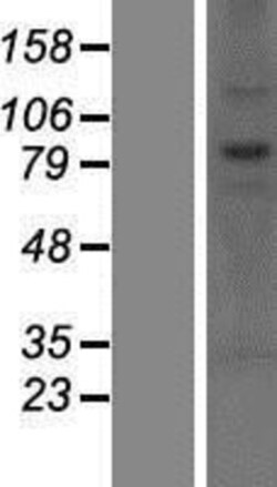 Novus Biologicals&trade;&nbsp;CNOT10 Overexpression Lysate