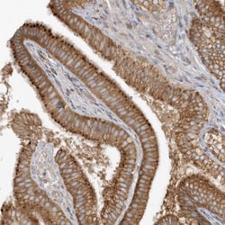 CNOT10 Antibody, Novus Biologicals 0.1mL; Unlabeled:Antibodies, Polyclonal