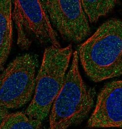 CNOT1 Antibody, Novus Biologicals:Antibodies:Primary Antibodies