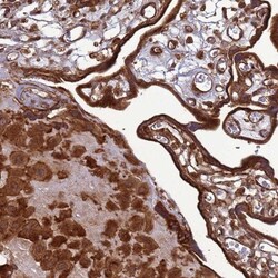 CNOT1 Antibody, Novus Biologicals 25 &mu;L, Unlabeled:Antibodies, Polyclonal