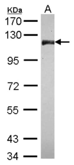 CNOT3 Antibody, Novus Biologicals 0.1mL; Unlabeled:Antibodies, Polyclonal