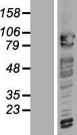 Novus Biologicals&trade;&nbsp;CNOT3 Overexpression Lysate
