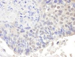 CNOT3 Antibody, Novus Biologicals 0.1mL; Unlabeled:Antibodies, Polyclonal