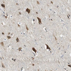 CNOT3 Antibody, Novus Biologicals 0.1mL; Unlabeled:Antibodies, Polyclonal