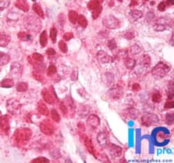 CNOT4 Antibody, Novus Biologicals:Antibodies:Primary Antibodies
