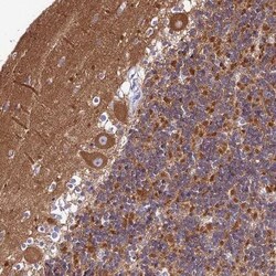 MECR Antibody, Novus Biologicals:Antibodies:Primary Antibodies