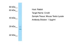 CNOT8 Antibody, Novus Biologicals 100 &mu;L | Buy Online | Novus Biologicals | Fisher Scientific