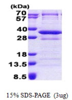 Novus Biologicals&trade;&nbsp;Recombinant Human CNOT8 His Protein