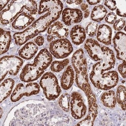 CNOT8 Antibody, Novus Biologicals:Antibodies:Primary Antibodies