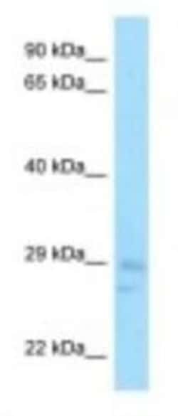 CNOT8 Antibody, Novus Biologicals 100 &mu;L | Buy Online | Novus Biologicals | Fisher Scientific