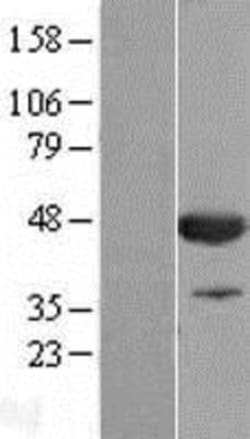 Novus Biologicals&trade;&nbsp;CNPase Overexpression Lysate