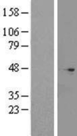 Novus Biologicals&trade;&nbsp;CNPPD1 Overexpression Lysate