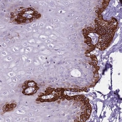 CNPPD1 Antibody, Novus Biologicals 0.1mL; Unlabeled:Antibodies, Polyclonal