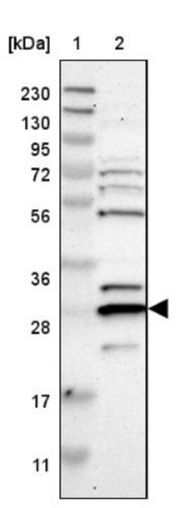 PRAT4B/CNPY4 Antibody, Novus Biologicals 0.1mL; Unlabeled:Antibodies, Polyclonal