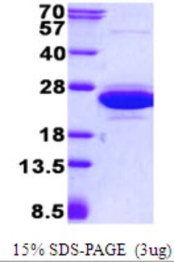 Novus Biologicals&trade;&nbsp;Recombinant Human CNRIP1 His Protein