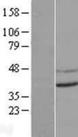 Novus Biologicals&trade;&nbsp;CNTD Overexpression Lysate