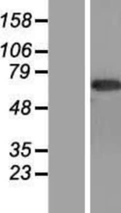 Novus Biologicals™ CNTFR Overexpression Lysate
