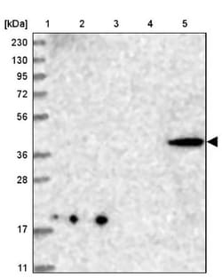 CNTLN Antibody, Novus Biologicals 0.1mL; Unlabeled:Antibodies, Polyclonal