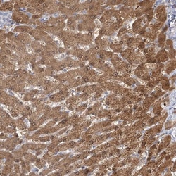 CNTLN Antibody, Novus Biologicals 0.1mL; Unlabeled:Antibodies, Polyclonal