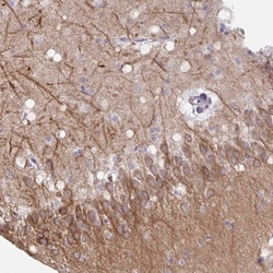 CNTNAP4 Antibody, Novus Biologicals:Antibodies:Primary Antibodies