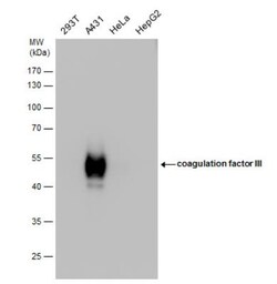 Coagulation Factor III/Tissue Factor Antibody, Novus Biologicals 0.1mL;