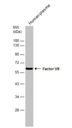 Coagulation Factor VII Antibody, Novus Biologicals 0.1 mL | Buy Online | Novus Biologicals | Fisher Scientific