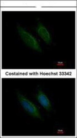 Coagulation Factor X Antibody, Novus Biologicals 0.1mL; Unlabeled:Antibodies,
