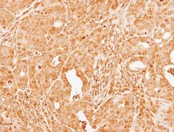 Coagulation Factor X Antibody, Novus Biologicals 0.1mL; Unlabeled:Antibodies,