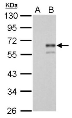 Coagulation Factor X Antibody, Novus Biologicals 0.1mL; Unlabeled:Antibodies,