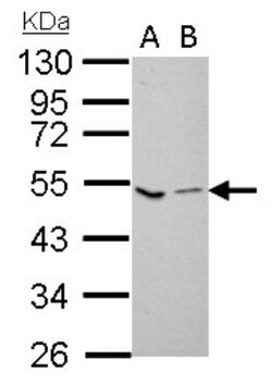 Coagulation Factor X Antibody, Novus Biologicals 0.1mL; Unlabeled:Antibodies,