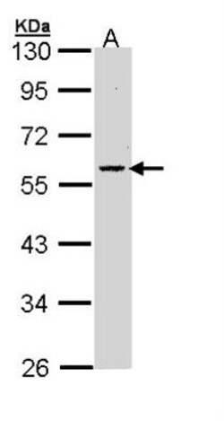 Coagulation Factor X Antibody, Novus Biologicals 0.1mL; Unlabeled:Antibodies,