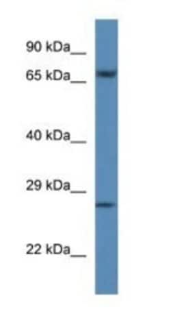 Coagulation Factor XI Antibody, Novus Biologicals 20 &mu;L | Buy Online | Novus Biologicals | Fisher Scientific