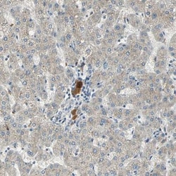 CIN85/SH3KBP1 Antibody, Novus Biologicals:Antibodies:Primary Antibodies