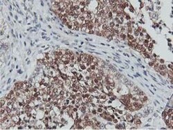 COASY Antibody (OTI3B3), Novus Biologicals 0.1mL; Unlabeled:Antibodies,