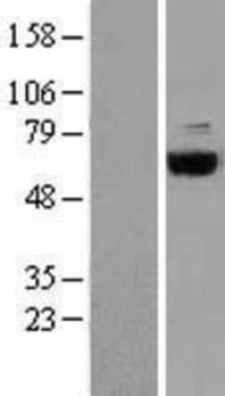 Novus Biologicals&trade;&nbsp;COASY Overexpression Lysate