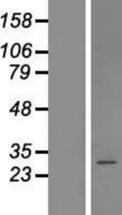 Novus Biologicals&trade;&nbsp;Coatomer protein complex, subunit zeta 2 Overexpression Lysate
