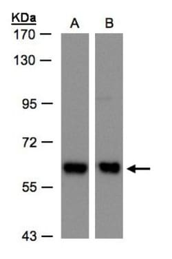 Coatomer Subunit Delta Antibody, Novus Biologicals 0.1mL; Unlabeled:Antibodies,