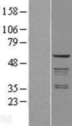 Novus Biologicals™ Coatomer Subunit Delta Overexpression Lysate