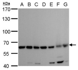 Coatomer Subunit Delta Antibody (1318), Novus Biologicals 0.1mL; Unlabeled:Antibodies,