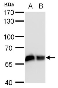 Coatomer Subunit Delta Antibody (1318), Novus Biologicals 0.1mL; Unlabeled:Antibodies,