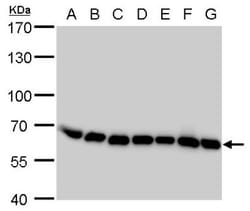 Coatomer Subunit Delta Antibody (189), Novus Biologicals 0.1mL; Unlabeled:Antibodies,